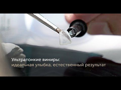 Ультратонкие виниры - новая технология для идеальной улыбки
