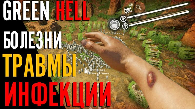 Как ЛЕЧИТЬ ТРАВМЫ, БОЛЕЗНИ, ИНФЕКЦИИ В Green Hell | Гайд