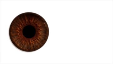 #кариеглаза #глаза 