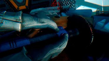 ТРЕТЬЯ РУКА ► Syndrome #4