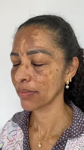 💯Face Pack For Tan Free Glowing Skin/Glowing Skin Tips #shorts #skinc...